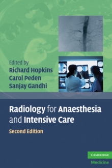 Radiology for Anaesthesia and Intensive Care