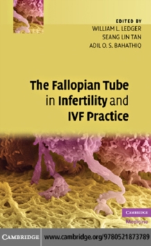 The Fallopian Tube in Infertility and IVF Practice