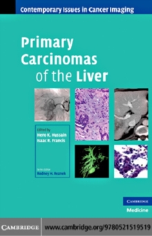 Primary Carcinomas of the Liver