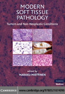 Modern Soft Tissue Pathology : Tumors and Non-Neoplastic Conditions