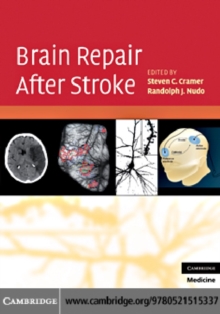 Brain Repair After Stroke