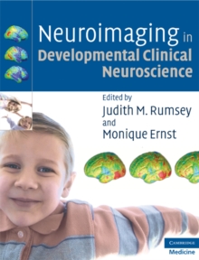 Neuroimaging in Developmental Clinical Neuroscience