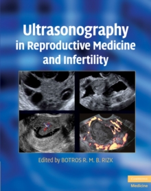 Ultrasonography in Reproductive Medicine and Infertility