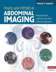 Pearls and Pitfalls in Abdominal Imaging : Pseudotumors, Variants and Other Difficult Diagnoses