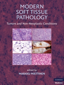 Modern Soft Tissue Pathology : Tumors and Non-Neoplastic Conditions