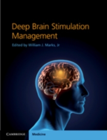 Deep Brain Stimulation Management