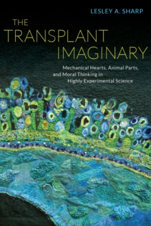 The Transplant Imaginary : Mechanical Hearts, Animal Parts, and Moral Thinking in Highly Experimental Science, Paperback / softback Book The Transplant Imaginary : Mechanical Hearts, Animal Parts, and Moral Thinking in Highly Experimental Science, Paperback / softback Book