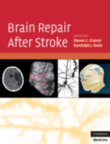 Brain Repair After Stroke, Hardback Book Brain Repair After Stroke, Hardback Book