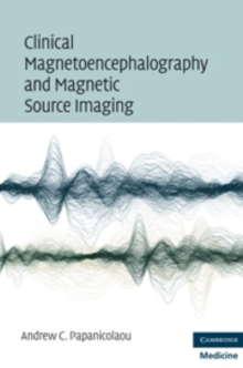 Clinical Magnetoencephalography and Magnetic Source Imaging, Hardback Book Clinical Magnetoencephalography and Magnetic Source Imaging, Hardback Book