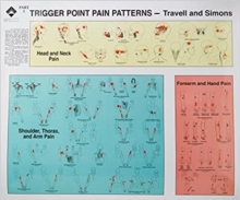 Trigger Point Pain Patterns Wall Charts, Wallchart Book Trigger Point Pain Patterns Wall Charts, Wallchart Book