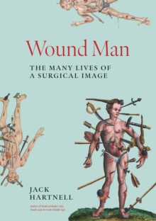 Wound Man : The Many Lives of a Surgical Image