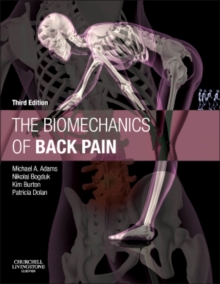 The Biomechanics of Back Pain