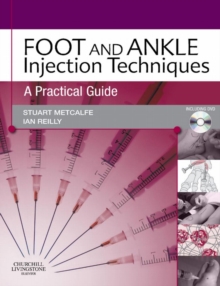 Foot and Ankle Injection Techniques : A Practical Guide