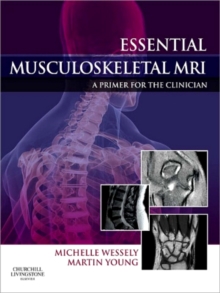 Essential Musculoskeletal MRI E-Book : Essential Musculoskeletal MRI E-Book