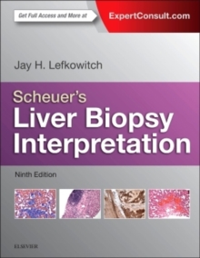 Scheuer's Liver Biopsy Interpretation, Hardback Book Scheuer's Liver Biopsy Interpretation, Hardback Book