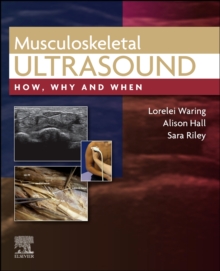 Musculoskeletal Ultrasound : How, Why and When