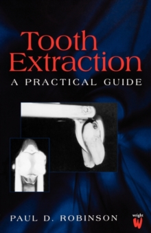 Tooth Extraction : A Practical Guide, Paperback / softback Book Tooth Extraction : A Practical Guide, Paperback / softback Book