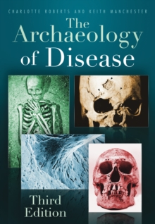 The Archaeology of Disease : Third Edition