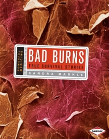 Bad Burns : True Survival Stories