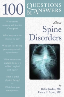 100 Questions & Answers About Spine Disorders, Paperback / softback Book 100 Questions & Answers About Spine Disorders, Paperback / softback Book
