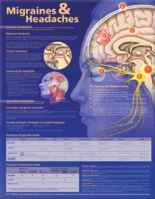 Migraines and Headaches Anatomical Chart, Wallchart Book Migraines and Headaches Anatomical Chart, Wallchart Book