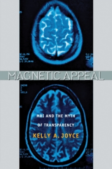 Magnetic Appeal : MRI and the Myth of Transparency