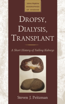 Dropsy, Dialysis, Transplant : A Short History of Failing Kidneys, Hardback Book Dropsy, Dialysis, Transplant : A Short History of Failing Kidneys, Hardback Book