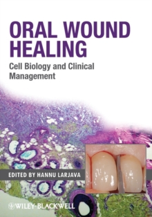 Oral Wound Healing : Cell Biology and Clinical Management, Hardback Book Oral Wound Healing : Cell Biology and Clinical Management, Hardback Book