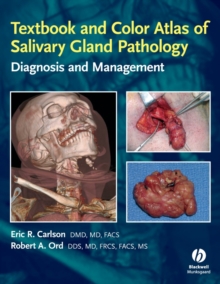 Textbook and Color Atlas of Salivary Gland Pathology : Diagnosis and Management