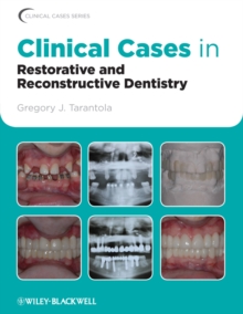 Clinical Cases in Restorative and Reconstructive Dentistry, Paperback / softback Book Clinical Cases in Restorative and Reconstructive Dentistry, Paperback / softback Book
