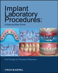 Implant Laboratory Procedures : A Step-by-Step Guide