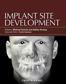 Implant Site Development, Hardback Book Implant Site Development, Hardback Book