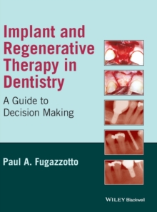 Implant and Regenerative Therapy in Dentistry : A Guide to Decision Making, Hardback Book Implant and Regenerative Therapy in Dentistry : A Guide to Decision Making, Hardback Book