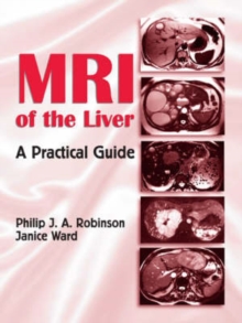 MRI of the Liver : A Practical Guide, Hardback Book MRI of the Liver : A Practical Guide, Hardback Book