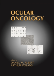 Ocular Oncology