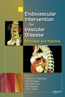 Endovascular Intervention for Vascular Disease : Principles and Practice, Hardback Book Endovascular Intervention for Vascular Disease : Principles and Practice, Hardback Book