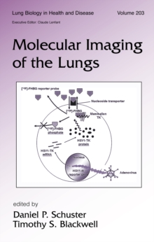 Molecular Imaging of the Lungs