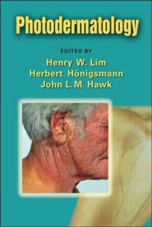 Photodermatology, Hardback Book Photodermatology, Hardback Book