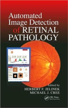Automated Image Detection of Retinal Pathology, Hardback Book Automated Image Detection of Retinal Pathology, Hardback Book