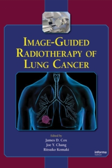 Image-Guided Radiotherapy of Lung Cancer