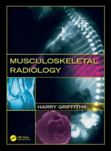 Musculoskeletal Radiology, Hardback Book Musculoskeletal Radiology, Hardback Book
