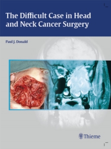 The Difficult Case in Head and Neck Cancer Surgery, Hardback Book The Difficult Case in Head and Neck Cancer Surgery, Hardback Book