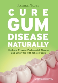 Cure Gum Disease Naturally : Heal Gingivitis And Periodontal Disease With Whole Foods