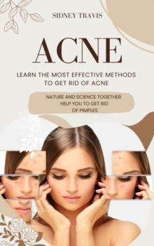 Acne : Learn the Most Effective Methods to Get Rid of Acne (Nature and Science Together Help You to Get Rid of Pimples)