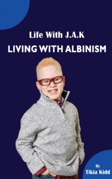 Life With J.A.K  Living with Albinism : Living with Albinism