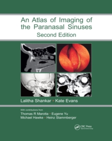 Atlas of Imaging of the Paranasal Sinuses, Second Edition