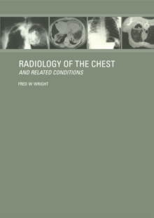 Radiology of the Chest and Related Conditions