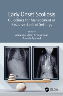 Early Onset Scoliosis : Guidelines for Management in Resource-Limited Settings