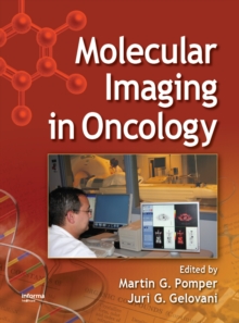 Molecular Imaging in Oncology