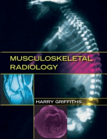 Musculoskeletal Radiology